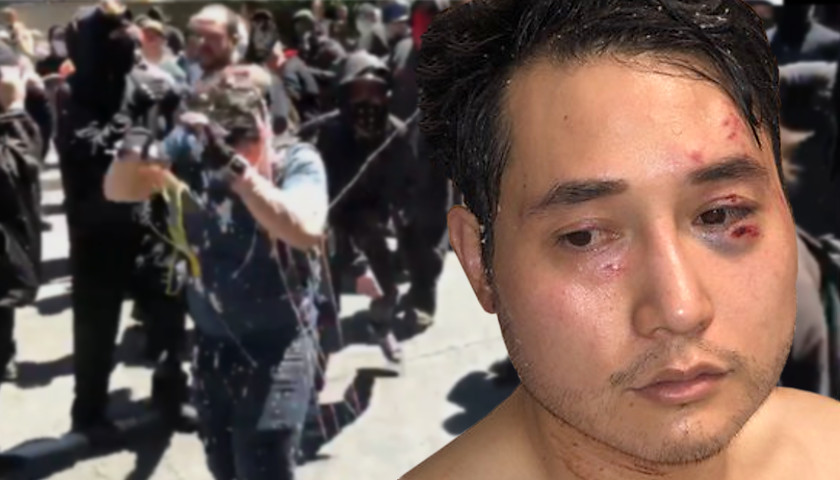 Andy ngo antifa attack 840x480